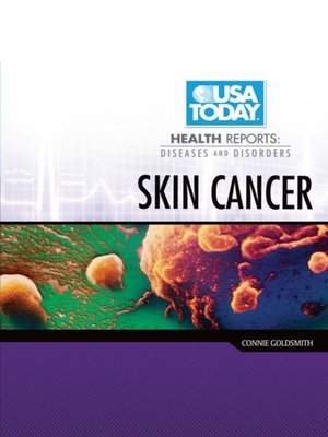 cover image of Skin Cancer